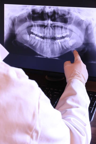 Best Emergency Tooth Extraction in Wyboo, SC