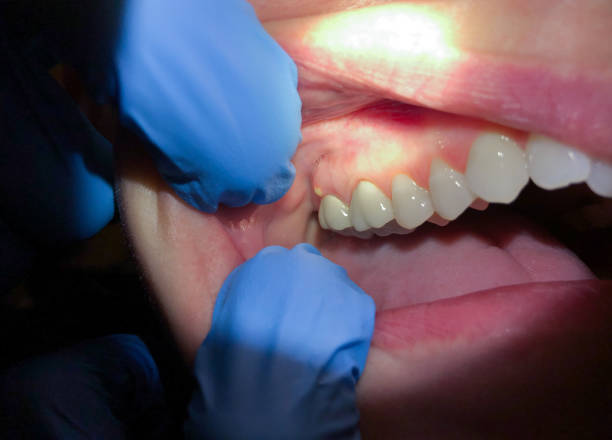 Best Emergency Denture Repair in Wyboo, SC